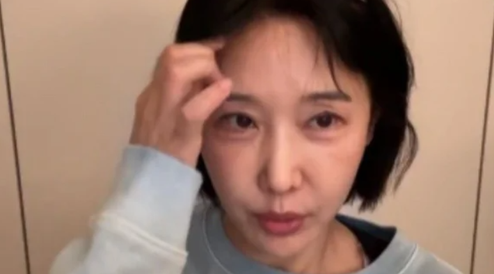 이수진 치과의사 근황4